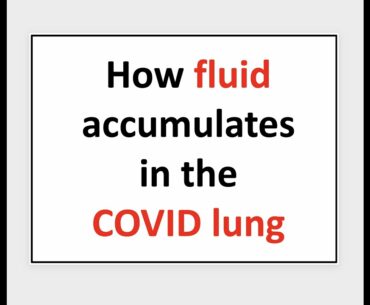 How fluid accumulates in the COVID lung