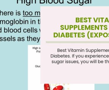 Best Vitamin Supplements For Diabetes (EXPOSED: Don't Buy Until You Watch This!)