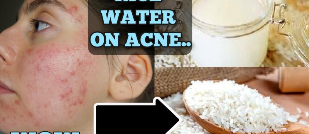 I Tested Rice Water for 1 Week Straight || SHOCKED BY THE RESULTS... THIS IS HOW MY SKIN LOOKS NOW..