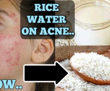 I Tested Rice Water for 1 Week Straight || SHOCKED BY THE RESULTS... THIS IS HOW MY SKIN LOOKS NOW..
