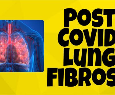 Post COVID-19 Lung Fibrosis | Dr Adarsh Singh