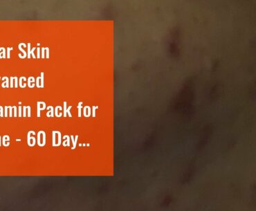 Clear Skin Advanced Vitamin Pack for Acne - 60 Day Supply of Vitamins for Acne