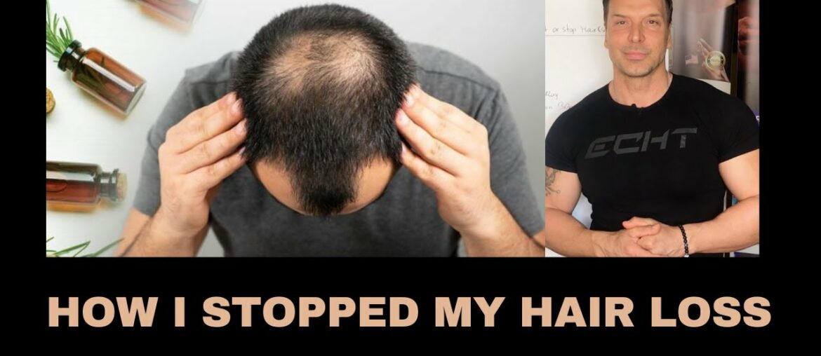 How i stopped my hair loss