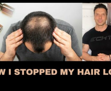 How i stopped my hair loss
