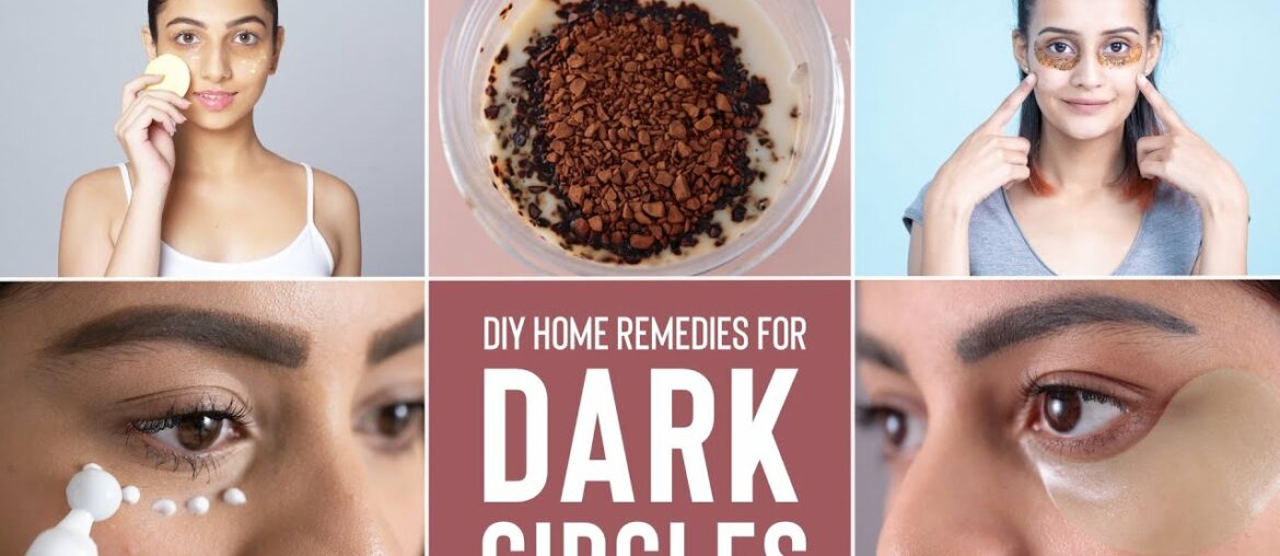 How To Get Rid Of DARK CIRCLES Naturally & Effectively | Home Remedies & DIY Masks!