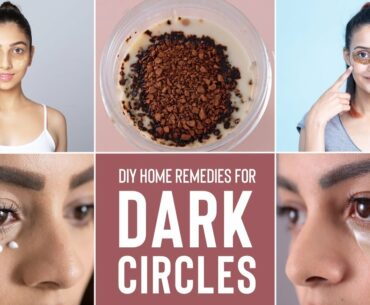 How To Get Rid Of DARK CIRCLES Naturally & Effectively | Home Remedies & DIY Masks!