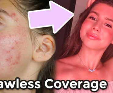 FOUNDATION FREE FLAWLESS ACNE COVERAGE MAKEUP ROUTINE!! || Chit Chat Back to School, Insecurities