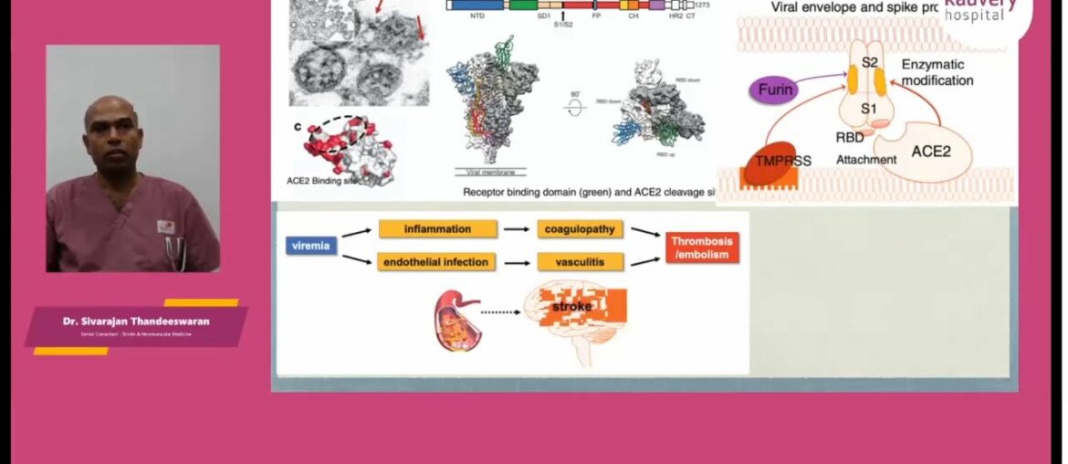 Neurovascular Complications of COVID19 | Dr Sivarajan Thandeswaran, Neurovascular &Stroke Specialist