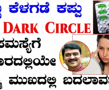 Remove Dark Circles Permanently  in 1 Week | Remove Dark Circles Kannada Vitamin - E   ( 100% Work )