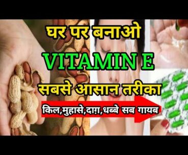 How to make Vitamin-E Oil Capsule at Home/Ghar pr Vitamin-E oil bnaye/Benefits Of Vitamin-E Oil