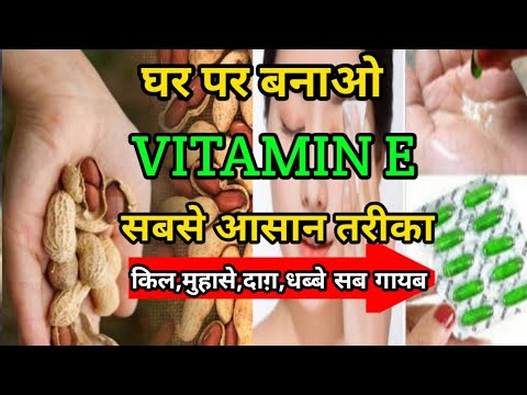 How to make Vitamin-E Oil Capsule at Home/Ghar pr Vitamin-E oil bnaye/Benefits Of Vitamin-E Oil