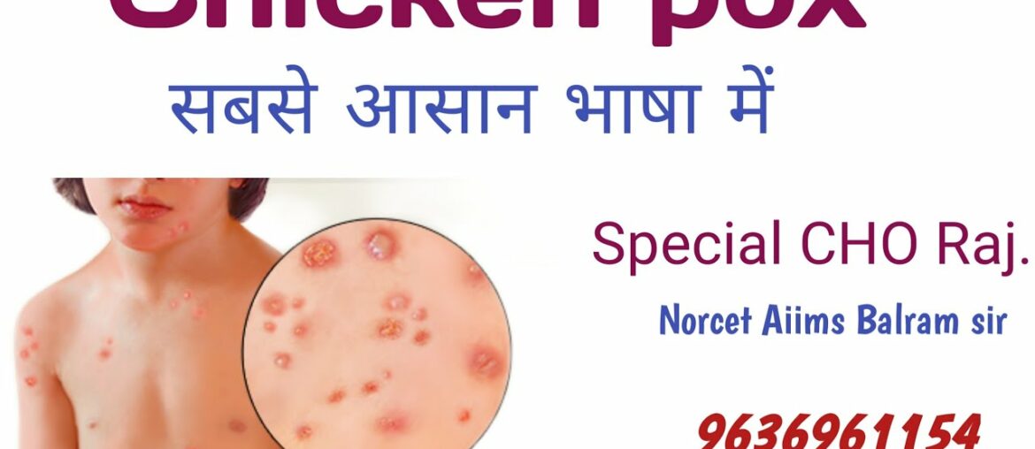 ||CHO Rajasthan|| |Chicken pox || For CHO & Nursing officer Exam ||