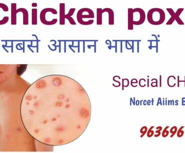 ||CHO Rajasthan|| |Chicken pox || For CHO & Nursing officer Exam ||