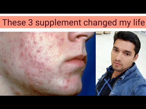 These 3 supplement changed my life||supplement for skin||supplement for hair growth||my changed life