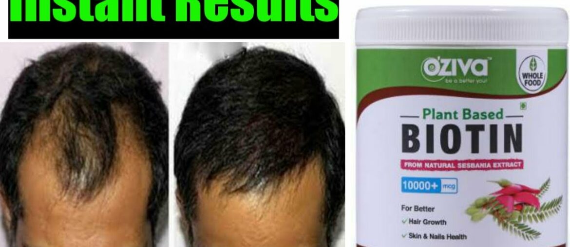 Oziva Plant Based Biotin Review || Best For Hair Growth/Nails/Skin