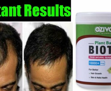 Oziva Plant Based Biotin Review || Best For Hair Growth/Nails/Skin
