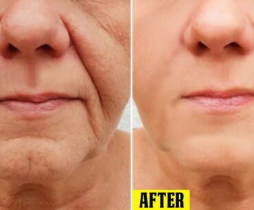 Look 18 Years younger Using Aloe Vera And Vitamin E-Anti-aging secrets-Anti Aging & Remove Wrinkles