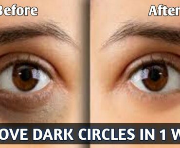 Remove Dark Circle Naturally || By Vitamin E Capsule || 100% Works