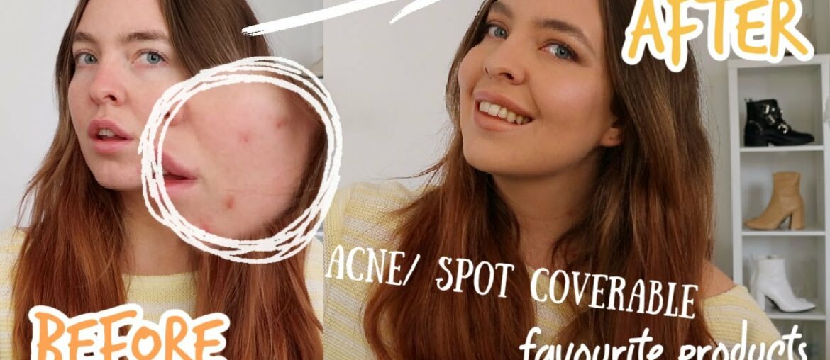CURRENT AUTUMN MAKEUP ROUTINE | SKIN & PRODUCT UPDATE (ACNE COVERABLE)