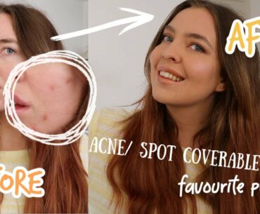 CURRENT AUTUMN MAKEUP ROUTINE | SKIN & PRODUCT UPDATE (ACNE COVERABLE)
