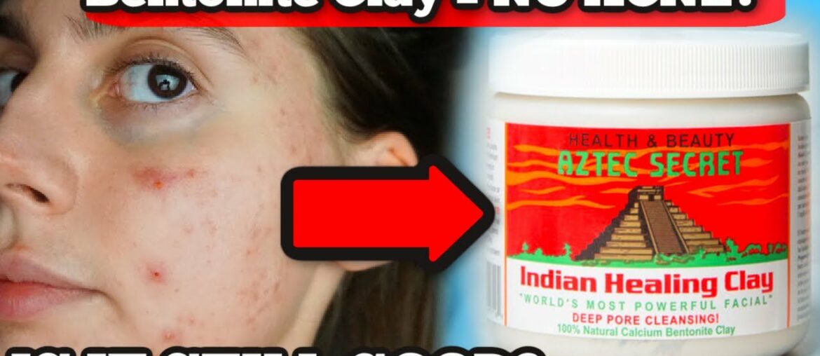 TESTING BENTONITE HEALING CLAY 3 YEARS LATER... HAS MY OPINION CHANGED ABOUT THIS MASK FOR ACNE!?