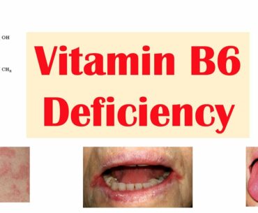 Vitamin B6 (Pyridoxine) Deficiency | Dietary Sources, Causes, Signs & Symptoms, Diagnosis, Treatment