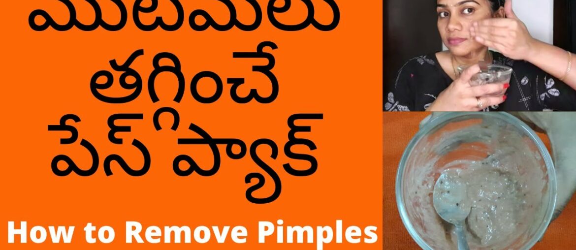 How To Get Rid Of Pimples / Acne, Dark Spots Naturally (100% Results) | Vitamin C Face Pack