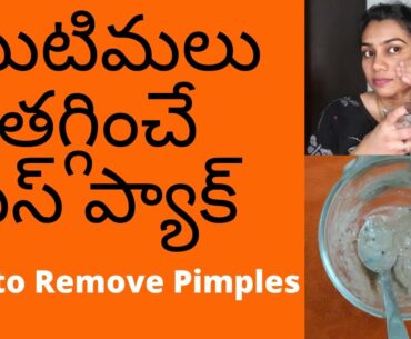 How To Get Rid Of Pimples / Acne, Dark Spots Naturally (100% Results) | Vitamin C Face Pack