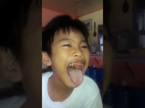 Ang Vitamins sa Batang Hyper