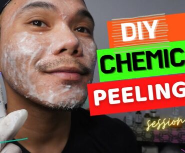 DIY Chemical Peeling At Home | Session 2