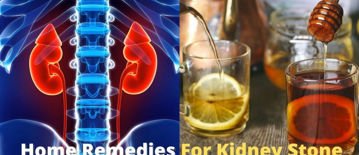 8 Easy Ways To Cleanse Your Kidneys Remove Stone From Kidneys | Health - Fitness