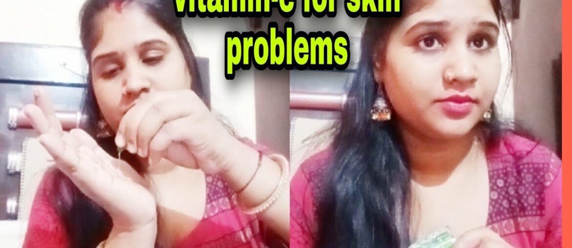 Vitamin - e  for skin problems