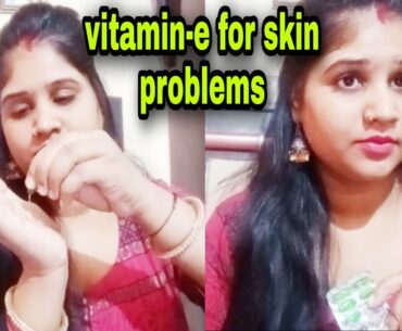 Vitamin - e  for skin problems