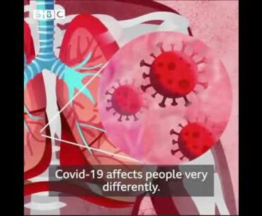 COVID19 can affect the lungs, respiratory system, mind, immune system, and other parts of the body