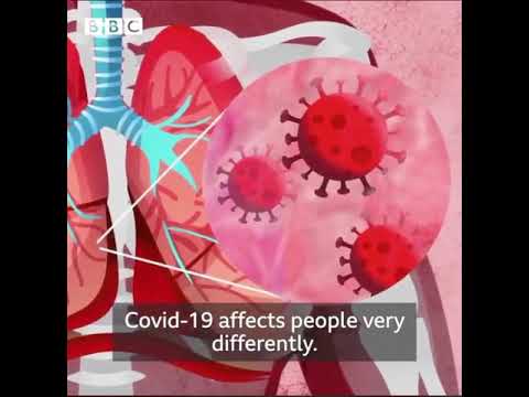 COVID19 can affect the lungs, respiratory system, mind, immune system, and other parts of the body