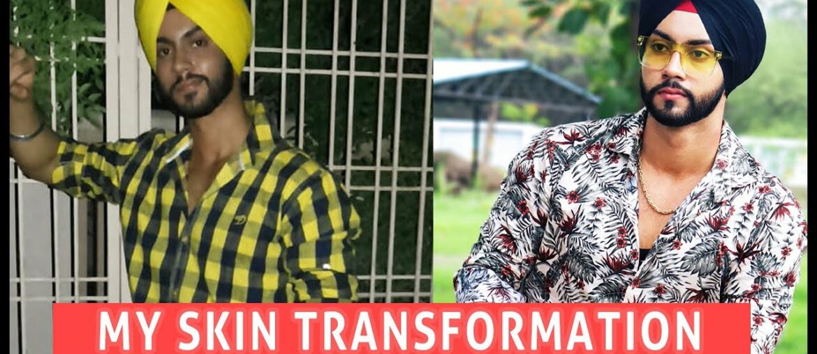 CRAZY TRANSFORMATION PT. 2 | MY JOURNEY FROM DARK TO FAIR SKIN | SKIN WHITENING | SAHEB SINGH |