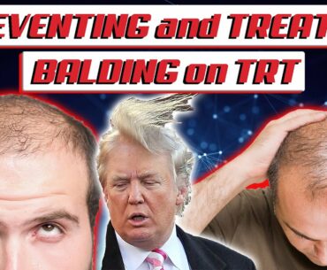 Preventing and Treating Balding on TRT/ Testosterone Replacement Therapy |  Prevent Hair Loss in TRT