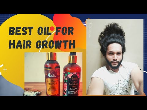 Oriental botanics Red Onion Hair Growth Oil review | Oriental botanics Red Onion Hair Growth Shampoo