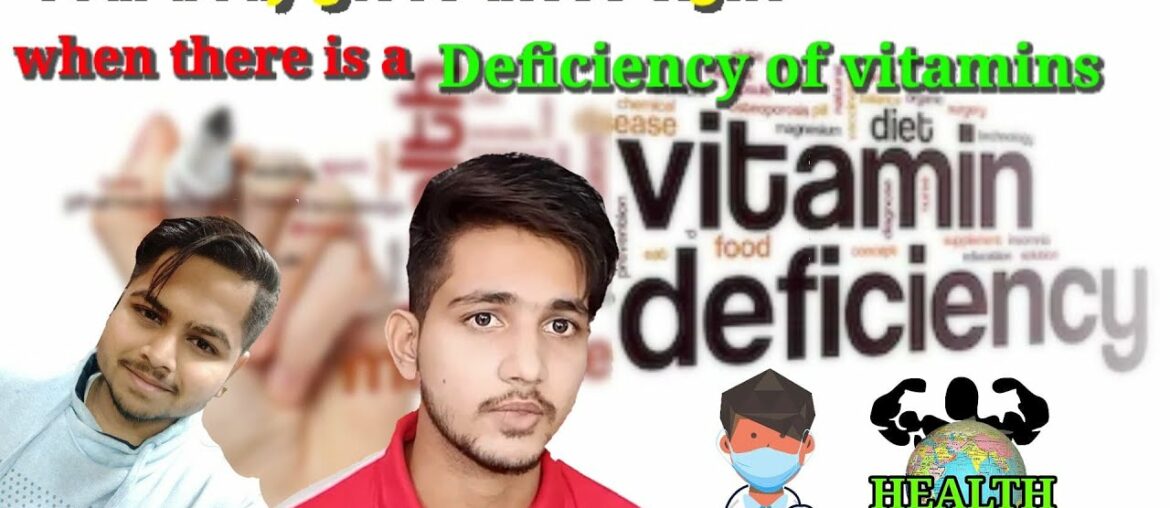 Deficiency of vitamins Health Planet 2020