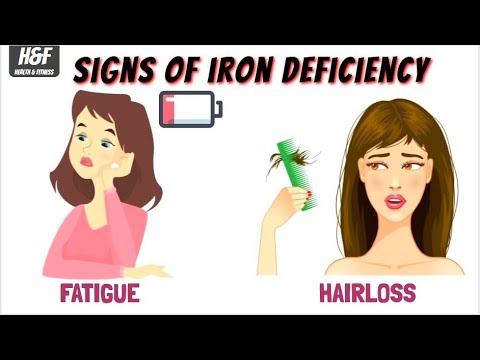 Top 5 Foods tips that W.H.O recommends to Prevent iron Deficiency