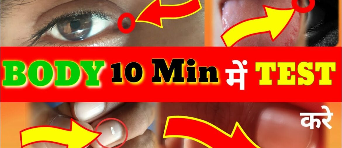 how to check multivitamin deficiency | bleeding gums solution | cracking sound in joints | In Hindi