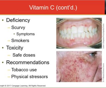 Week 7 Lecture Vitamin C and B Vitamins