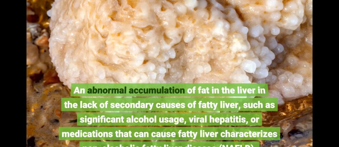 The Single Strategy To Use For Alpha lactone vitamin