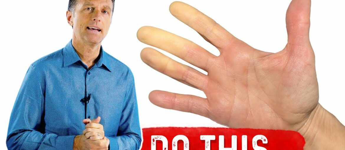 Raynaud's Syndrome: Do This...