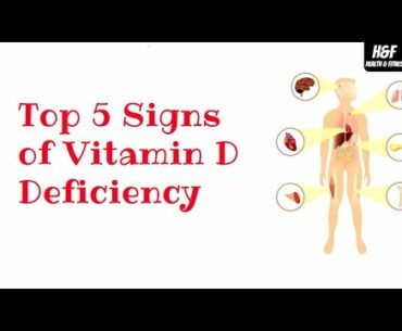 Top 5 Signs of Vitamin D Deficiency | Symptoms of Vitamin-D Deficiency