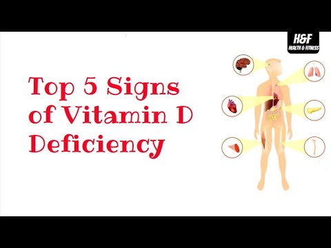 Top 5 Signs of Vitamin D Deficiency | Symptoms of Vitamin-D Deficiency