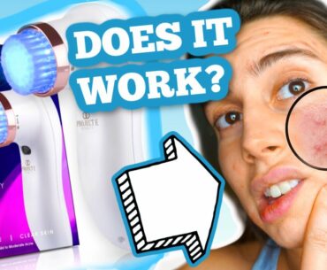 CAN BLUE LIGHT THERAPY HEAL ACNE QUICK?! find out here, literally can't believe it..