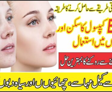 Evion Capsules Uses For Skin & Hair Part 2 I Natural Reasources of Vitamin-E I Side Effects of Evion