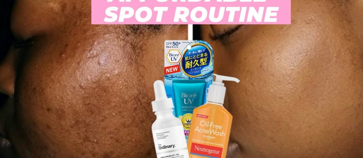 Affordable Skincare Routine for Hyperpigmentation