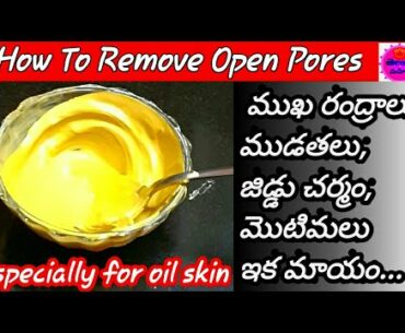 How To Remove Open Pores In Telugu /Beauty Tips In Telugu /How To Get Glowing Skin Naturally At Home